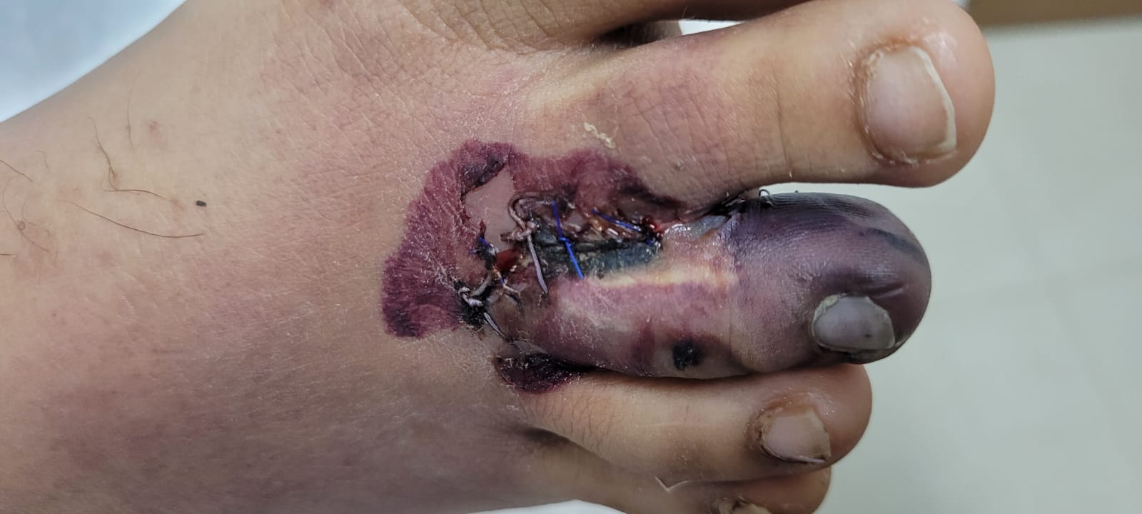 Las Siete Cicatrices Del Lider - Descarga | PDF | Oración | Perdón, image size:1600x720